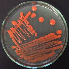 Rhodotorula grown in a petri dish. It is a common environmental inhabitant that exists almost everywhere.