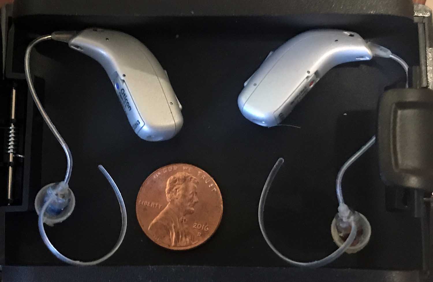 The tiny technology of modern hearing aids.