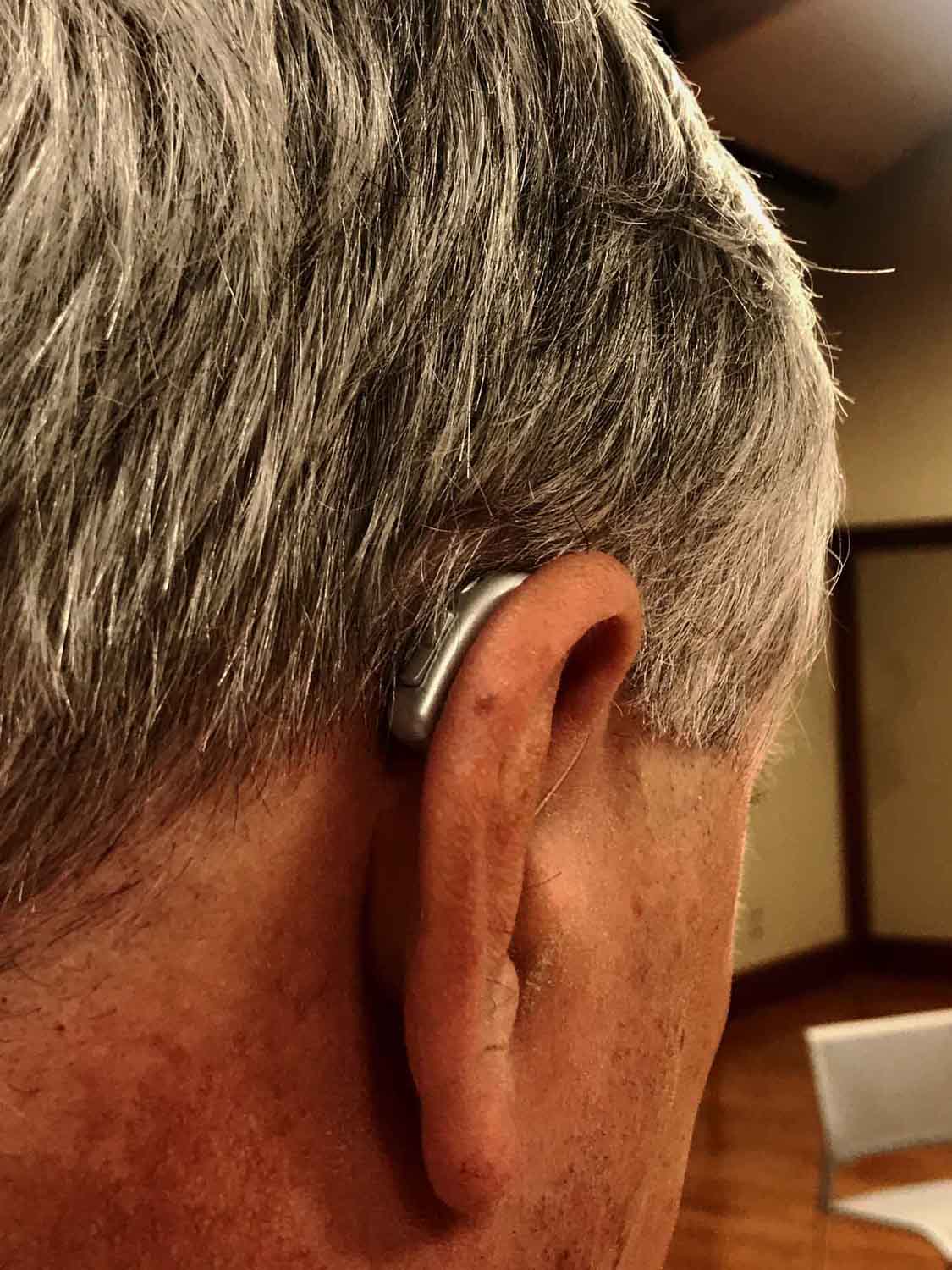 One of Skye Richendrfer's discreet hearing aids.